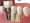 Dental Implants – The Ideal Replacements for Your Missing Teeth