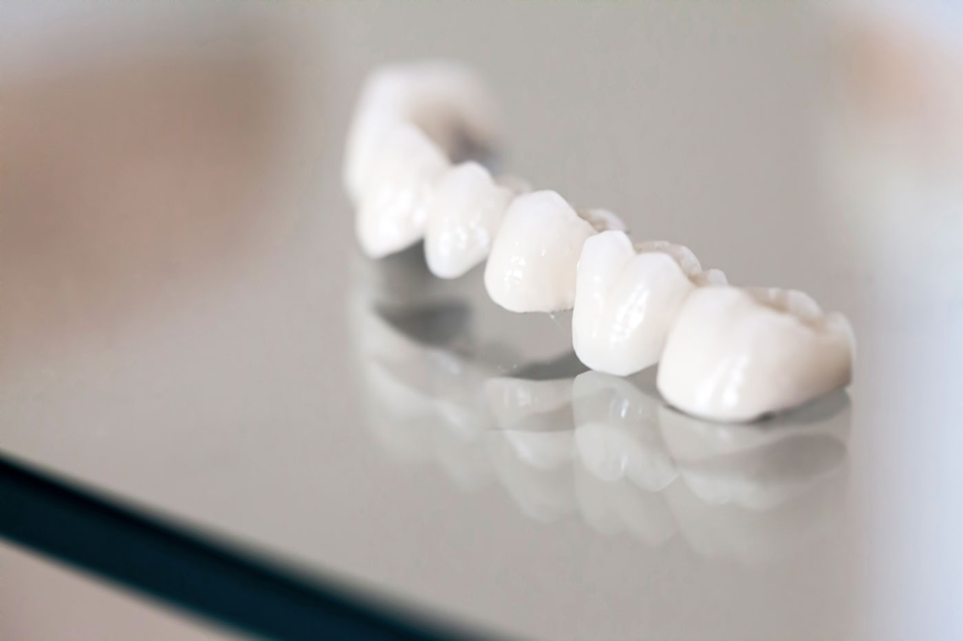 Porcelain Dental Veneers, Crowns and Bridges – A Brief Intro